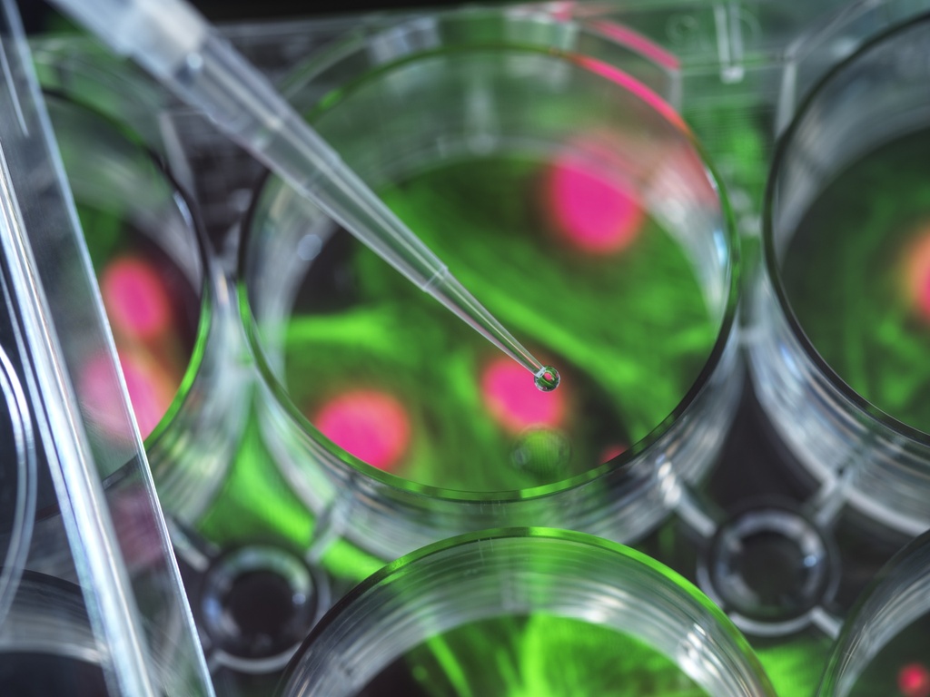 Cell lines (SH-SY5Y or HEK293) expressing different fluorescent tau proteins and mutants
