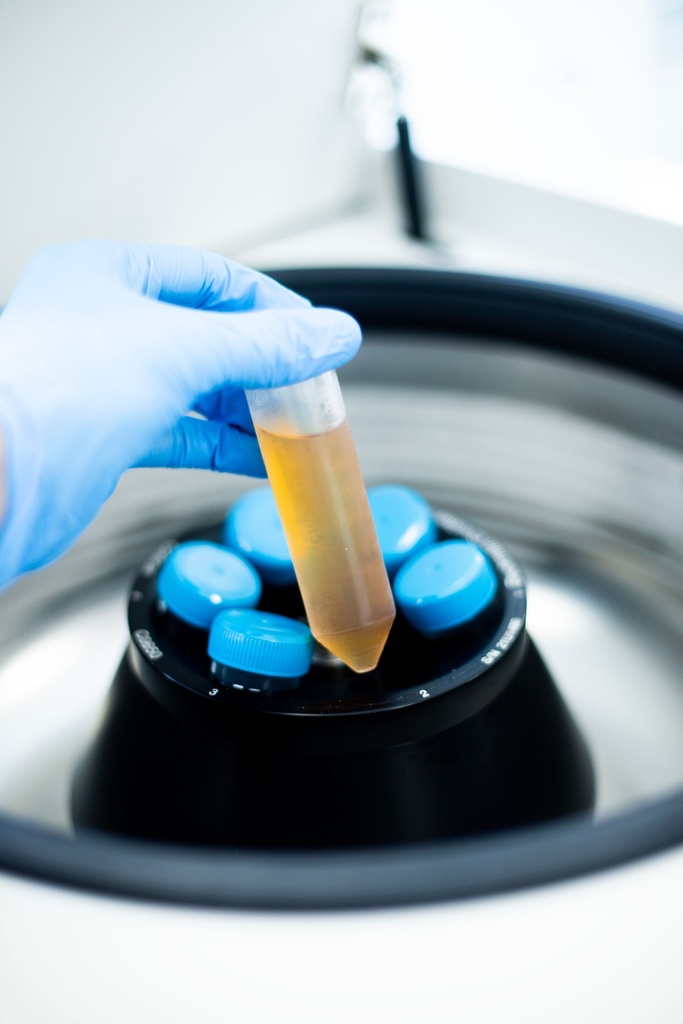 15mL High-Speed 17,000xg Centrifuge Tube, Red Screw Cap, Printed Graduations, STERILE